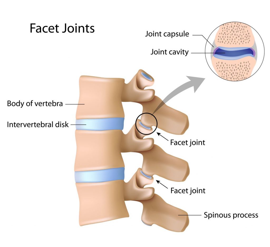 What Is The Meaning Of Diffuse Disc Bulge